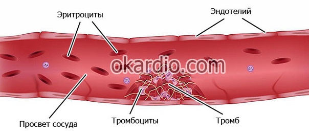 ПРОФИЛАКТИКА ОБРАЗОВАНИЯ ТРОМБОВ 1. Пейте больше воды! 90% людей пьют очень мало воды. Речь именно о кипяченой природной воде, а не о жидкостях. Взрослый человек должен выпивать ежедневно 2-2,5